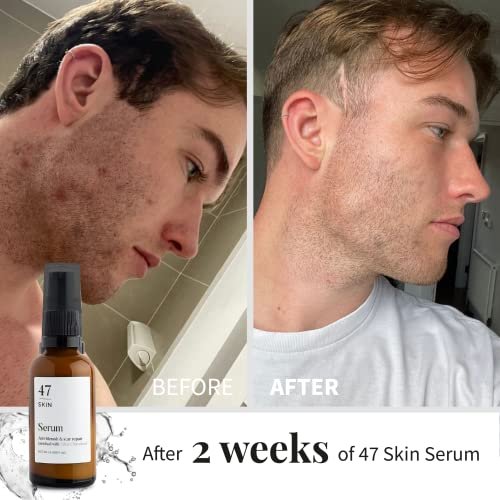 47 Skin Hydrating Face Serum for Clearing Acne & Scars, Anti-Blemish & Scar Repair Serum Skincare Treatment with Silver Chitoderm - Smooth Skin Moisturiser Facecare Serum for All Skin Types (1.01 oz) - Image 6