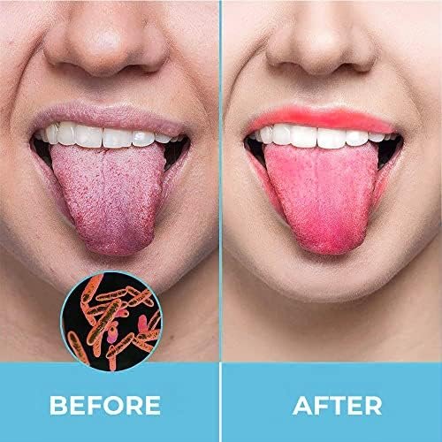 Tongue Scraper for Adults by HOKIN (2Pcs Oral Care Pack) Stainless Steel Tongue Cleaners Reduce Bad Breath 100% Metal Tough Scrapers Men and Women Hygiene Product - Image 6