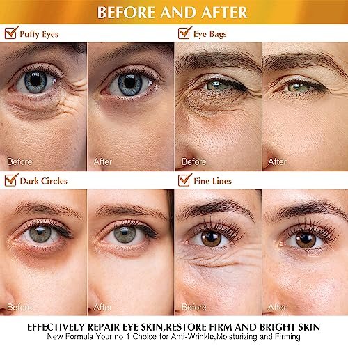 Enaskin Naturals Under Eye Patches Dark Circles Under Eye Masks for Puffiness - 24K Gold Eye Gel Pads Retinol Collagen Hyaluronic Acid Moisturizing & Reducing Wrinkles (24K Gold) - Image 3